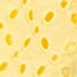Resort Gold